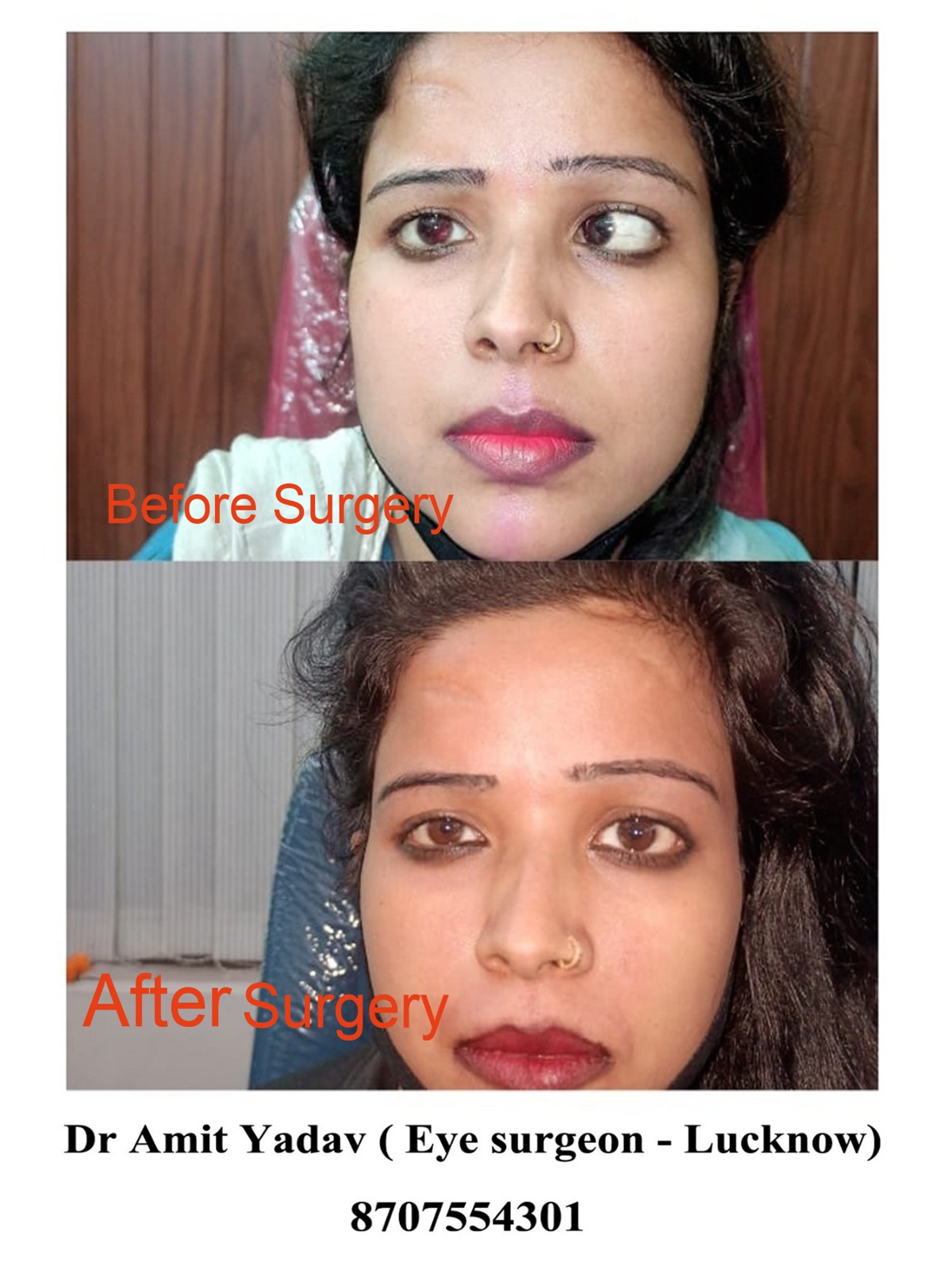 surgery-2.jpeg